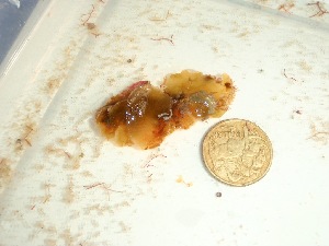  ( - GWS037789)  @11 [ ] Unspecified (default): All Rights Reserved  Unspecified Unspecified