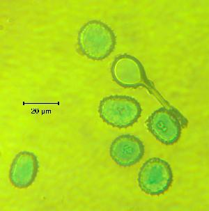  (Melampsora rostripii - 01G1.1)  @11 [ ] Copyright (2009) Richard Hamelin Laboratory Natural Resources Canada