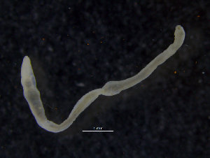  (Lumbriclymene sp - ZMBN_98165)  @11 [ ] CreativeCommons - Attribution Non-Commercial Share-Alike (2015) University of Bergen University of Bergen, Natural History Collections