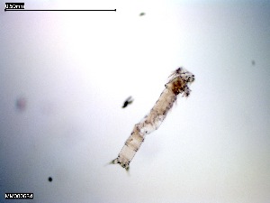  (Cylindronannopus - MM000534_crustaceans_Harpacticoida_Pseudotachidiidae)  @11 [ ] © (2020) Dr. Nancy F. Mercado Salas German Center for Marine Biodiversity Research