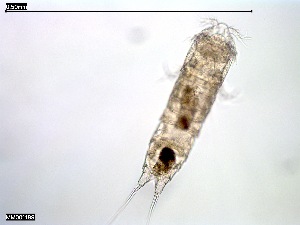  ( - MM001189_crustaceans_Harpacticoida_Pseudotachidiidae)  @11 [ ] © (2020) Dr. Nancy F. Mercado Salas German Center for Marine Biodiversity Research