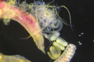  ( - ZMBN_161000)  @11 [ ] Creative Commons BY NC SA (2024) University of Bergen Natural History Collections