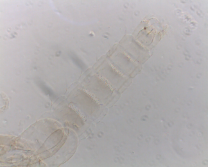  (Onconeura oncovolsella - SW-00004)  @13 [ ] CreativeCommons - Attribution (2010) CBG Photography Group Centre for Biodiversity Genomics
