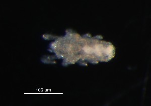  (Triophtydeidae - MYMCA-07-44)  @12 [ ] CreativeCommons - Attribution (2011) Monica Youn Centre for Biodiversity Genomics