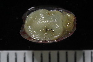  ( - ZMBN_125136)  @11 [ ] CreativeCommons - Attribution Non-Commercial Share-Alike (2018) University of Bergen Natural History Collections