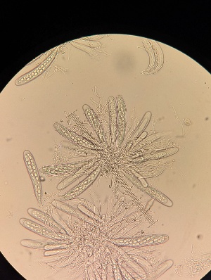  ( - M24MAR0015D2_FB114)  @11 [ ] by-sa (2025) Norwegian marine fungi Institute of marine research