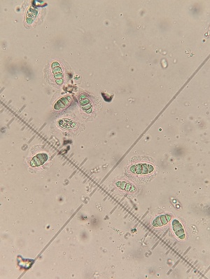  (Sphaerulina amicta - M24MAR0012D8_FB118)  @11 [ ] by-sa (2025) Norwegian marine fungi Institute of marine research