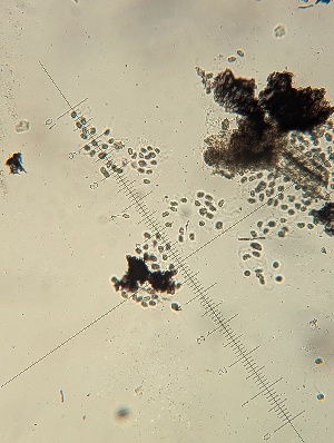  (Ceriosporopsis - M24GOS2577D4_FB121)  @11 [ ] by-sa (2025) Norwegian marine fungi Institute of marine research