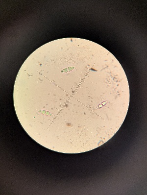  (Ceriosporopsis capillacea - M24MAR0027D2_FB124)  @11 [ ] by-sa (2025) Norwegian marine fungi Institute of marine research