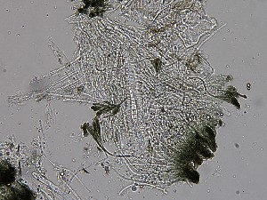  ( - TRa2024-117_FB151)  @11 [ ] by-sa (2025) Norwegian marine fungi UiT The Arctic University of Norway