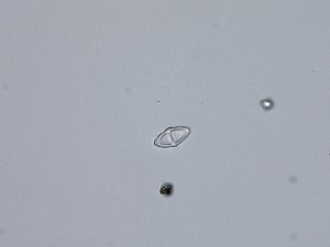  (Halosphaeria pileata - TRa2022-96d)  @11 [ ] by-sa (2023) Norwegian marine fungi UiT The Arctic University of Norway