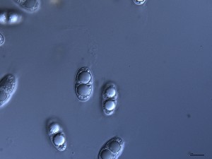  (Ceriosporopsis halima - M24NMF0002D2_NMF148_Culture)  @11 [ ] by-sa (2025) Norwegian marine fungi UiT The Arctic University of Norway