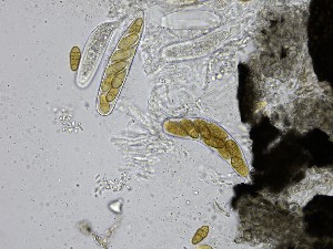  (Stemphylium - TRa2023-151b_NMF136_Culture)  @11 [ ] by-sa (2025) Norwegian marine fungi UiT The Arctic University of Norway