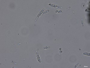  ( - M24NMF0018a_FB51)  @11 [ ] by-sa (2025) Norwegian marine fungi UiT The Arctic University of Norway