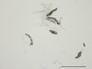  (Chaetothyriales - TRa3151a_FB31)  @11 [ ] by-sa (2025) Norwegian marine fungi UiT The Arctic University of Norway