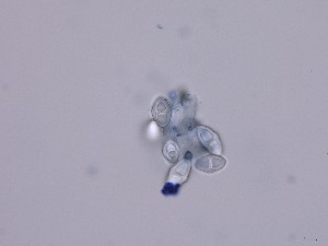  ( - TRa2022-47a)  @11 [ ] by-sa (2023) Norwegian marine fungi UiT The Arctic University of Norway