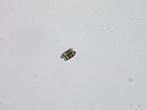  ( - TRa2023-124b_NMF120_Culture)  @11 [ ] by-sa (2025) Norwegian marine fungi UiT The Arctic University of Norway