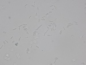  (Sarocladiaceae - SG2023-10a_NMF84_Culture)  @11 [ ] by-sa (2025) Norwegian marine fungi UiT The Arctic University of Norway