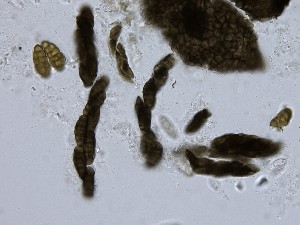  (Pleospora - TRa2023-33)  @11 [ ] by-sa (2023) Norwegian marine fungi UiT The Arctic University of Norway