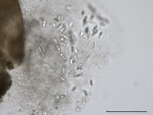  (Lignincola - TRa2023-150)  @11 [ ] by-sa (2025) Norwegian marine fungi UiT The Arctic University of Norway