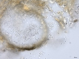  ( - TRa2022-16b_NMF58_Culture)  @11 [ ] by-sa (2025) Norwegian marine fungi UiT The Arctic University of Norway