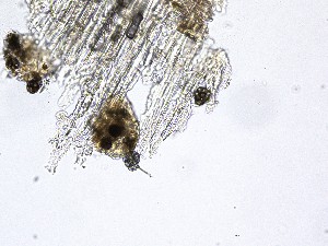  (Scedosporium - M24NMF0019a_NMF220_Culture)  @11 [ ] by-sa (2025) Norwegian marine fungi UiT The Arctic University of Norway