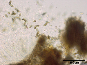  (Lophiostoma compressum - TROM-F15862)  @11 [ ] CreativeCommons - Attribution Non-Commercial Share-Alike (2015) Unspecified Tromso University Museum