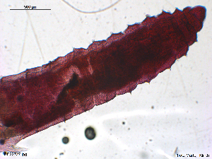  (Lumbricillus pagenstecheri B - CE22727)  @11 [ ] CreativeCommons - Attribution Non-Commercial Share-Alike (2018) Christer Erseus University of Gothenburg