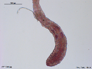  (Lumbricillus rubidus - CE34300)  @11 [ ] CreativeCommons - Attribution Non-Commercial Share-Alike (2018) Christer Erseus University of Gothenburg