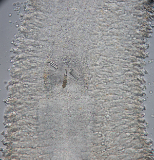  ( - Hoplo_ETP076_SMPP0698)  @11 [ ] CreativeCommons  Attribution Non-Commercial Share-Alike (2020) Unspecified Smithsonian Tropical Research Institute