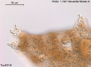  (Macrobiotus islandicus - Tard06)  @11 [ ] Creative Commons  Attribution Non-Commercial Share-Alike (2016) NTNU University Museum, Department of Natural History NTNU University Museum, Department of Natural History