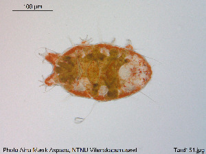  (Diploechiniscus - Tard151)  @11 [ ] Creative Commons  Attribution Non-Commercial Share-Alike (2018) NTNU University Museum, Department of Natural History NTNU University Museum, Department of Natural History