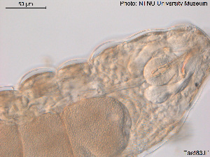  (Macrobiotus vladimiri - Tard83)  @11 [ ] Creative Commons  Attribution Non-Commercial Share-Alike (2016) NTNU University Museum, Department of Natural History NTNU University Museum, Department of Natural History