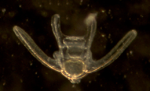  ( - RE-OrK-OP-11915)  @11 [ ] CreativeCommons  Attribution (by) (2015) Richard Emlet Oregon Institute of Marine Biology
