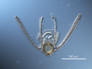  ( - RE-O2-101514)  @11 [ ] CreativeCommons  Attribution (by) (2014) Richard Emlet Oregon Institute of Marine Biology