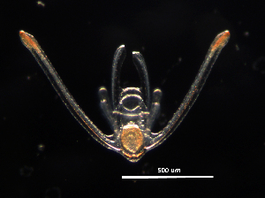  ( - RE-O1-101514)  @11 [ ] CreativeCommons  Attribution (by) (2014) Richard Emlet Oregon Institute of Marine Biology