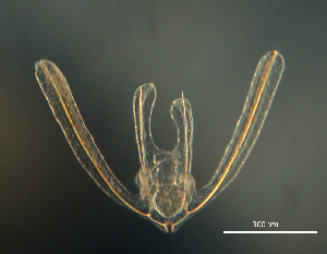  ( - RE-Or10818)  @11 [ ] CreativeCommons  Attribution (by) (2018) Richard Emlet Oregon Institute of Marine Biology