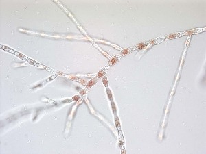  (Acrochaetiac sp. 1Aus - JAW4243)  @11 [ ] Unspecified (default): All Rights Reserved  Unspecified Unspecified