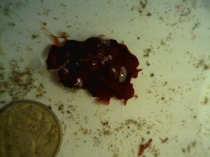  ( - GWS023595)  @11 [ ] Unspecified (default): All Rights Reserved  Unspecified Unspecified