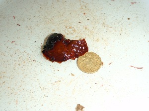  ( - GWS034011)  @11 [ ] Unspecified (default): All Rights Reserved  Unspecified Unspecified