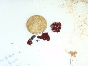  ( - GWS034060)  @11 [ ] Unspecified (default): All Rights Reserved  Unspecified Unspecified
