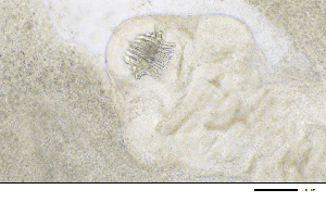  (Taeniidae - PAVEA_Hd4701)  @11 [ ] by-sa - CreativeCommons - Attribution Share-Alike  Unspecified University of Veterinary Medicine, Vienna