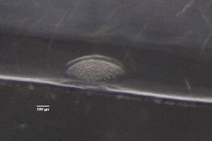  (Diphyllobothriidea - PZ0188)  @11 [ ] by-nc-sa (2023) Luis Martell University Museum of Bergen, Natural History Collections