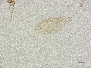  ( - BIOUG95270-A01)  @11 [ ] CreativeCommons - Attribution Share Alike (2025) CBG Photography Group Centre for Biodiversity Genomics