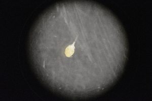 (Dirivultidae - PES17ISS1COP01)  @11 [ ] CreativeCommons  Attribution (by) (2018) Unspecified Woods Hole Oceanographic Institution