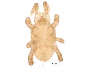  (Antennoseius sp. JCS04 - BIOUG32459-B11)  @11 [ ] CreativeCommons - Attribution (2017) CBG Photography Group Centre for Biodiversity Genomics