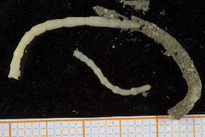  ( - UMBergen_NB_polych106)  @11 [ ] Unspecified (default): All Rights Reserved (2014) Unspecified Unspecified