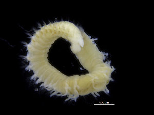  ( - ZMBN_104609)  @11 [ ] CreativeCommons - Attribution Non-Commercial Share-Alike (2015) UoB, Norway University of Bergen, Natural History Collections