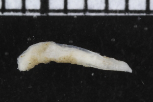  ( - ZMBN_104797)  @11 [ ] CreativeCommons - Attribution Non-Commercial Share-Alike (2015) UoB, Norway University of Bergen, Natural History Collections