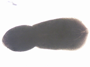  (Posthodiplostomum sp. 25 SAL-2022 - P.Da10.Yag.1.41b)  @11 [ ] CreativeCommons  Attribution Share-Alike (by-sa) (2020) Sandra Diaz Unspecified